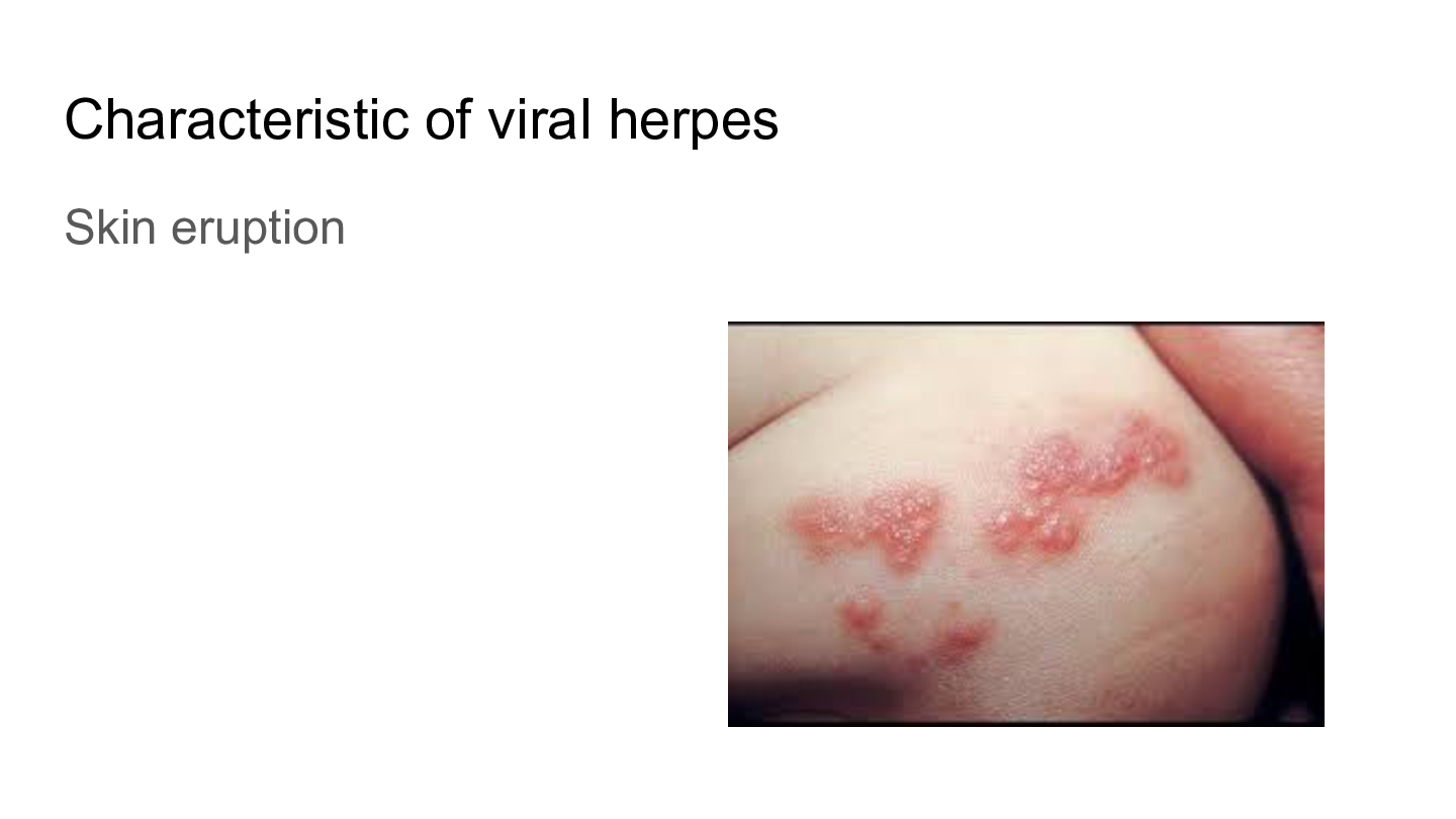 Preview image for AP-Hesi-A2-Hesi-A2